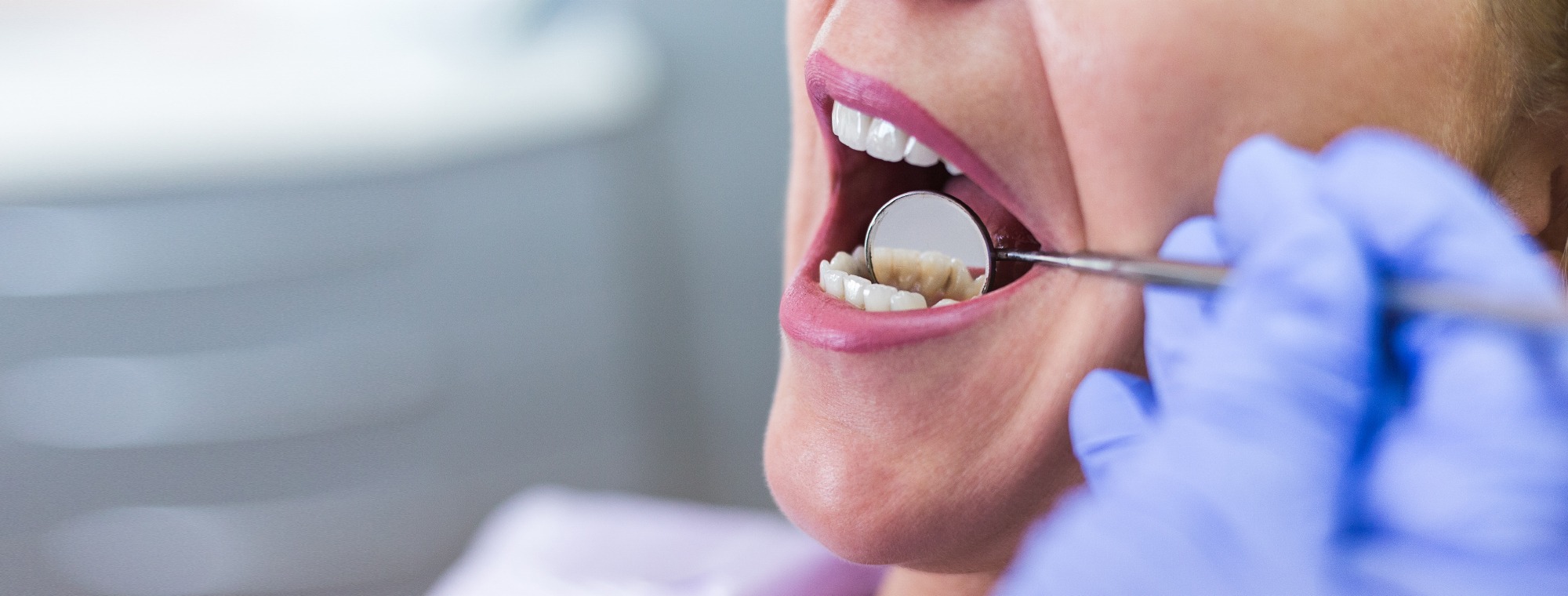 Cosmetic Dentist Chesterfield Teeth Whitening Veneers Chesterfield